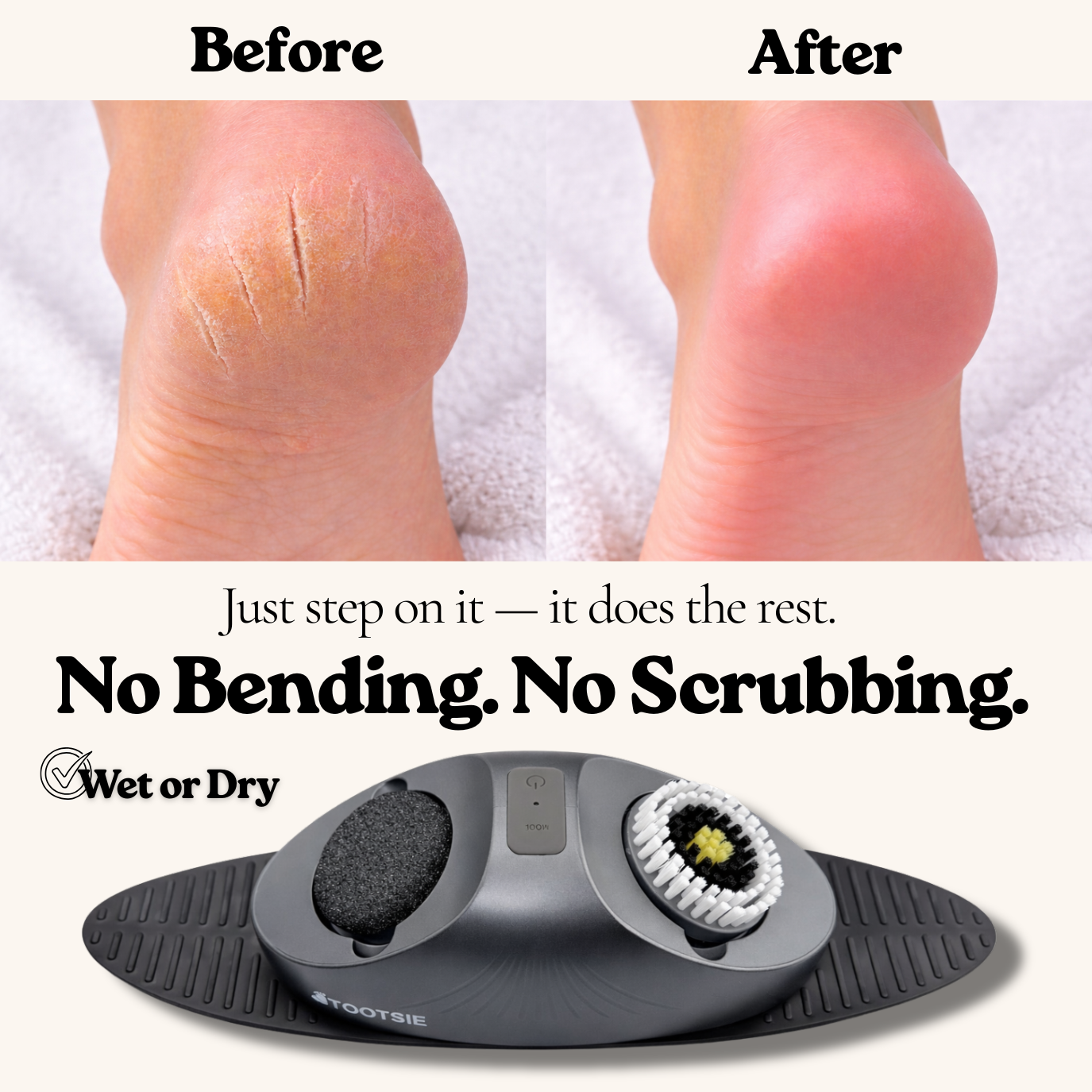 Electric Foot Callus Remover Rechargeable — Waterproof Hands-Free Pedicure Tool for Hard Skin & Cracked Heels